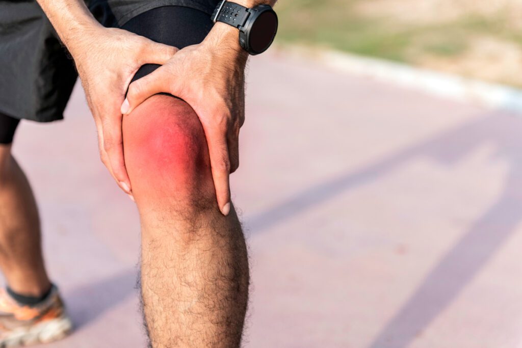 A man grasping his knee, which looks inflamed.