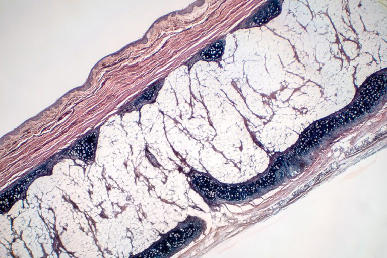 View of a Human hyaline cartilage bone under a microscope
